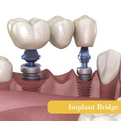 WhatsApp Görsel 2025-05-25 saat 19.15.36_51636251