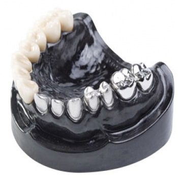 metal destekli porselen 2