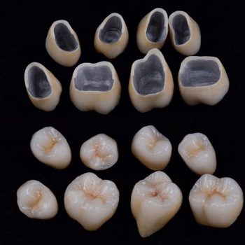 metal destekli porselen 3