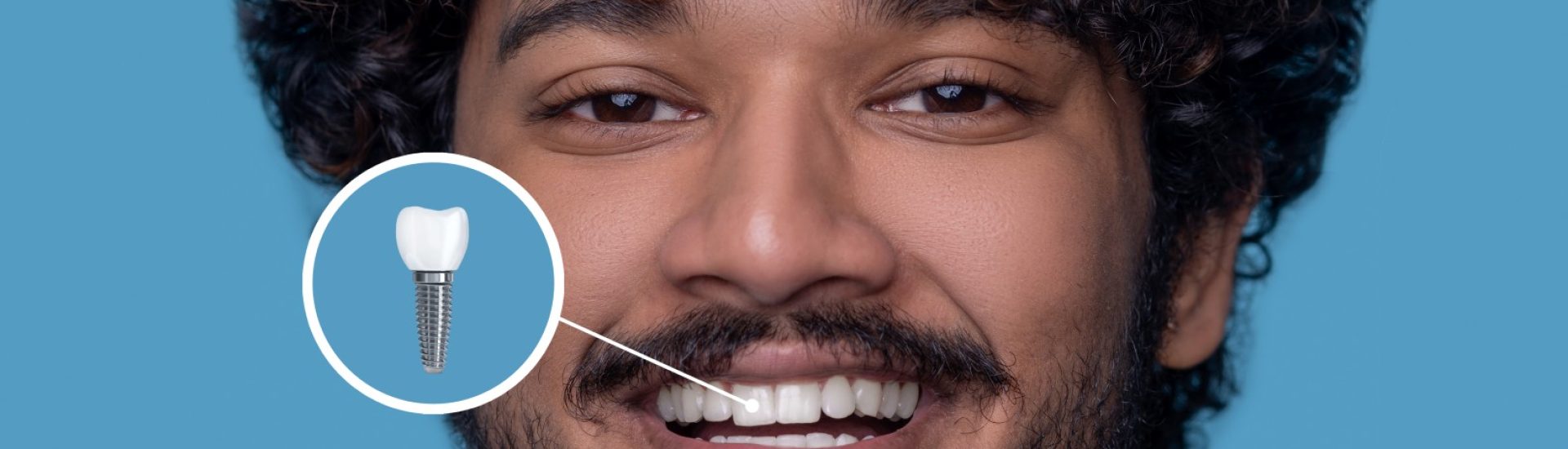 Headshot of a happy attractive guy with open mouth showing his white teeth before the camera